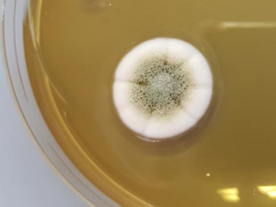 Mold Testing | Mold Species Identification | Mold Colony Morphology on Culture Media