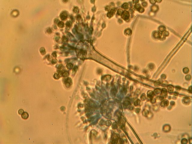 Photomicrographs of Fungi