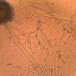Photomicrographs of Fungi