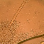 Photomicrographs of Fungi