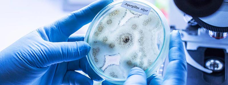 Mold in petri dish being studies in the laboratory | How to detect the presence of mold