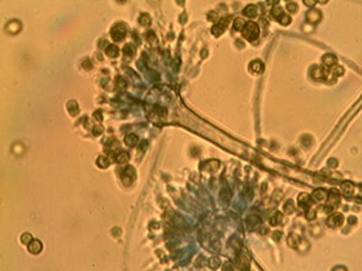 Mold Testing | Mold Species Identification | Microscopic Staining Morphology