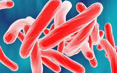 IAQ Provides Solution to Curtail Spread of Tuberculosis in Buildings