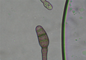 spores sampling